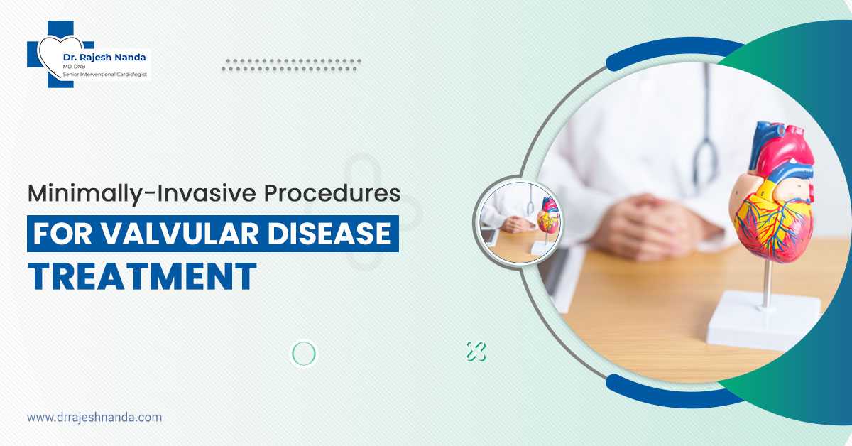 heart doctor in siliguri